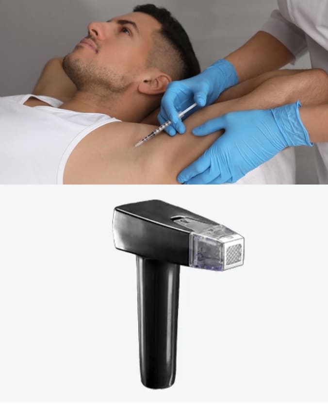 Why Choose Phoenix Cosmetic Centre for Hyperhidrosis Treatment?